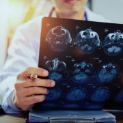 Οι ασθενείς Covid-19 με νευρολογικά συμπτώματα έχουν εξαπλάσια πιθανότητα να πεθάνουν, σύμφωνα με διεθνή μελέτη