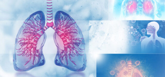 Ένα γαλλικό σύστημα τεχνητής νοημοσύνης μπορεί να κάνει διαγνώσεις του καρκίνου των πνευμόνων έως ένα χρόνο νωρίτερα