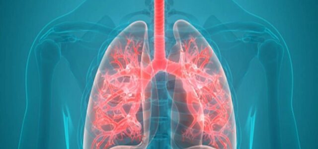 Καρκίνος του Πνεύμονα: Μείωση των θανάτων κατά 25% αν εφαρμοστεί ο προσυμπτωματικός έλεγχος