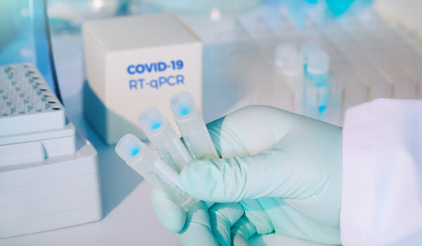 Πλαφόν 47 ευρώ βάζει η κυβέρνηση στο τεστ PCR