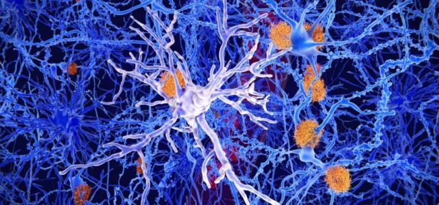 Το ανοσοποιητικό σύστημα «κρύβει συμμάχους» κατά του Αλτσχάιμερ
