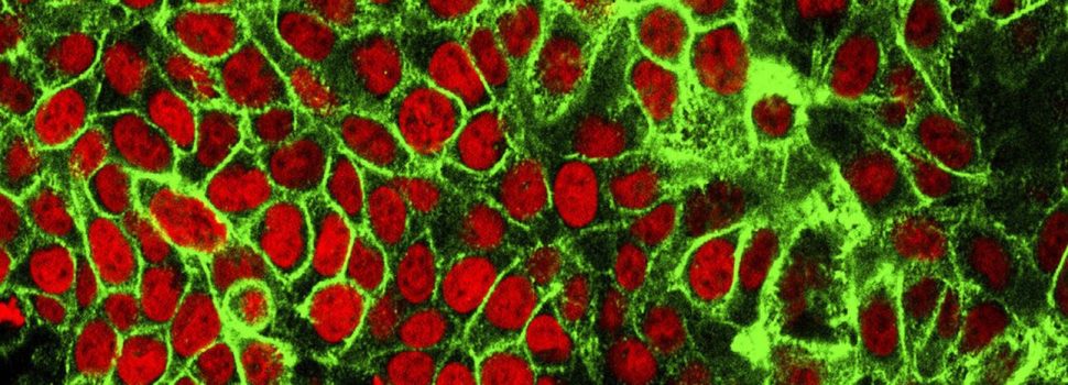 Επιστήμονες αποκαλύπτουν: Πώς ιοί εκατομμυρίων ετών καταπολεμούν τον καρκίνο