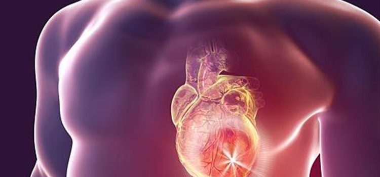 ΕΚΕ: Ενημερωτικές δράσεις για την καρδιακή ανεπάρκεια – 200.000 ασθενείς στη χώρα μας πάσχουν από τη νόσο