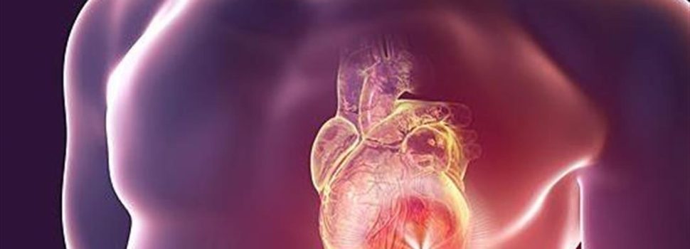 ΕΚΕ: Ενημερωτικές δράσεις για την καρδιακή ανεπάρκεια – 200.000 ασθενείς στη χώρα μας πάσχουν από τη νόσο