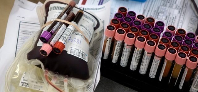 Εξετάσεις αίματος μπορούν να προσδιορίσουν με ακρίβεια τους ασθενείς με long Covid