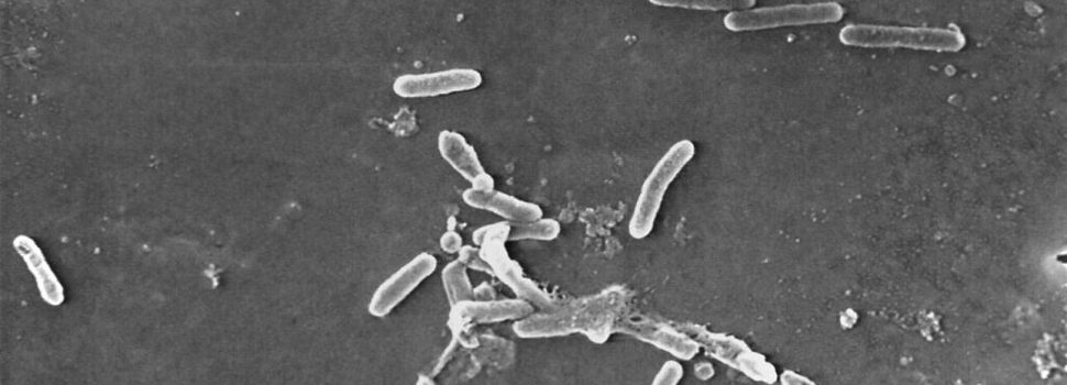 Μικροβιακή αντοχή: Η αόρατη πανδημία που κοστίζει στο σύστημα υγείας 124 εκατ. ευρώ