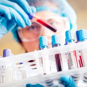 Νέο τεστ αίματος ανιχνεύει 18 μορφές καρκίνου σε πρώιμο στάδιο